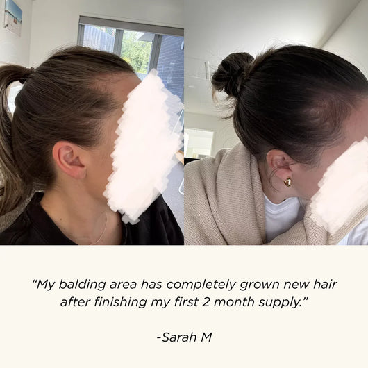 2% Deoxyribose - Scalp Serum